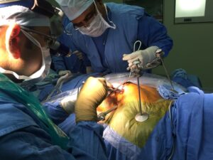 heart transplant in indore, angioplasty surgery in indore